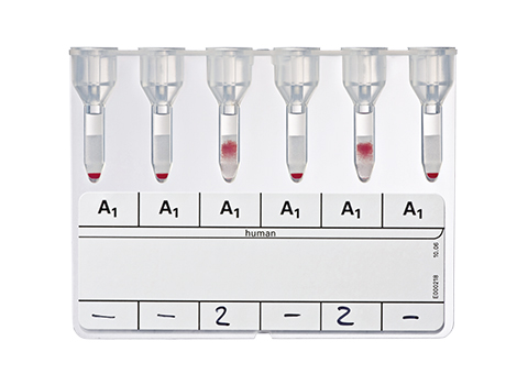 Bio-Rad_50140_Anti-A1 Absorbed.jpg