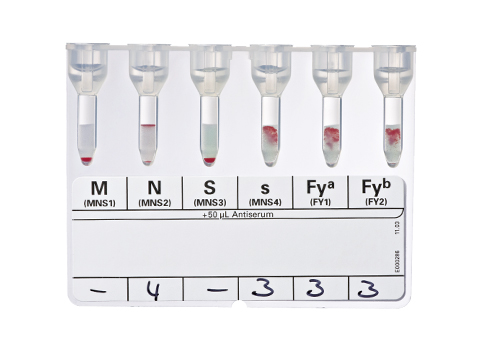 Bio-Rad_50390_45140_ID-Antigen Profile III_II.jpg