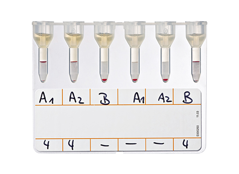 Bio-Rad_50520_NaCl,-Enzyme-Test-and-Cold-Agglutinins_Reverse-Grouping.jpg