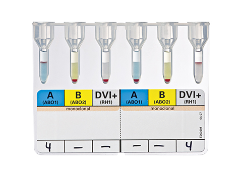 Bio-Rad_51051_DiaClon ABD-Confirmation for Donors.jpg