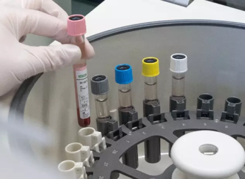 Independent quality controls from Bio-Rad